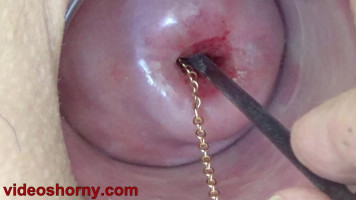 Cute neck chain inserted in cervix with speculum on